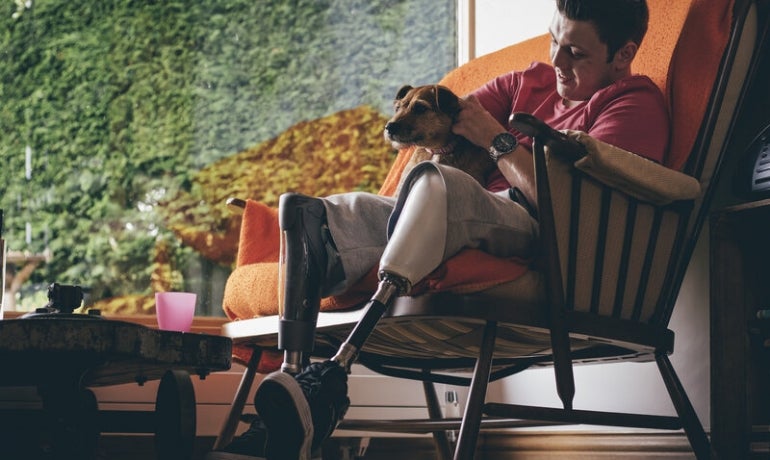 A young man is sitting in an armchair patting a dog. He is wearing prosthetic lower legs.